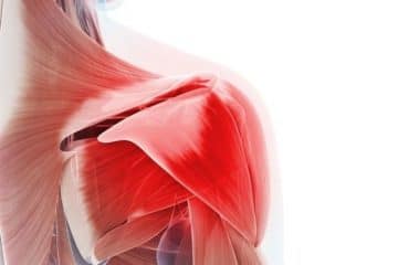 3 Tips to Relieve Frozen Shoulder